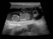 Mira image